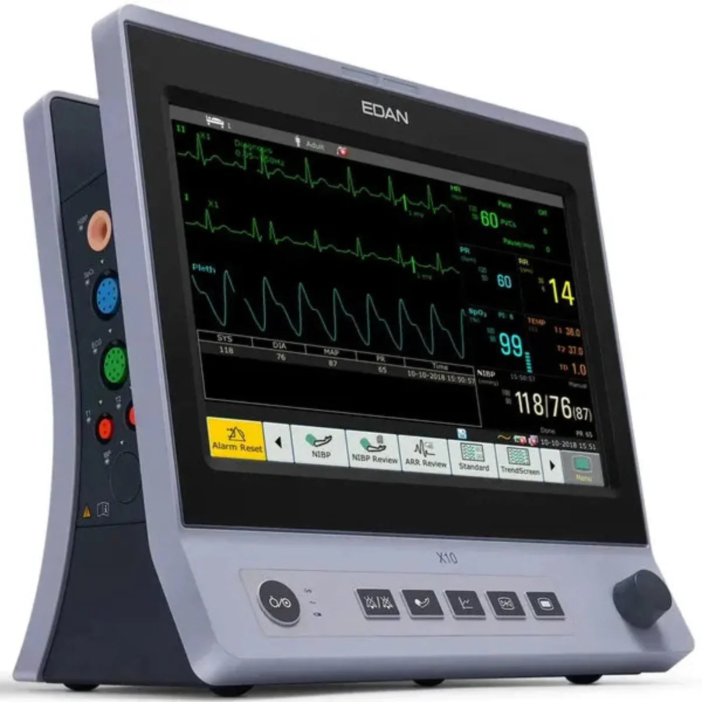 Edan i15 Vet Blood Gas and Chemistry Analyzer (POCT) -  EDN-X10